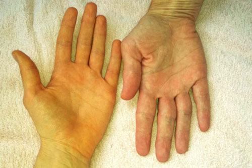 Cơ thể xuất hiện 7 dấu hiệu này cần đi khám ngay, gan của bạn đang kêu cứu thảm thiết