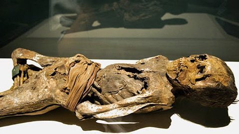 Săn xác ướp để chữa... béo phì