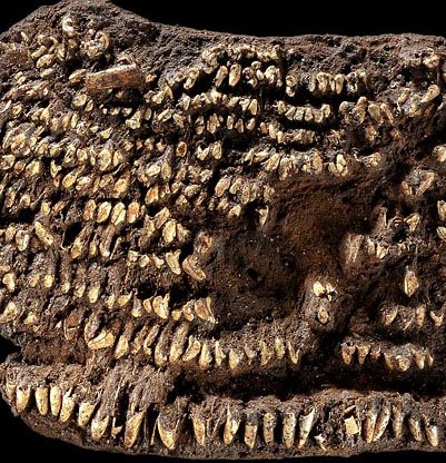 Dù không ăn đường, uống nước có ga nhưng người cổ đại vẫn bị sâu răng?