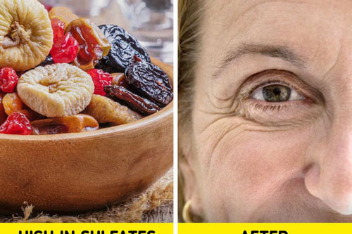 Hãy tránh xa 11 loại thực phẩm này nếu muốn có làn da tươi trẻ