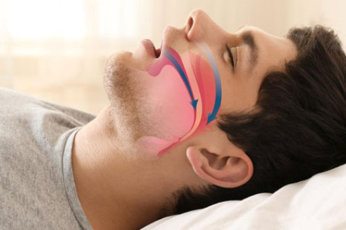 5 dấu hiệu bất thường khi ngủ chứng tỏ sức khỏe nguy hiểm cận kề