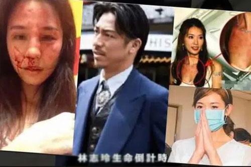 Rộ tin Lâm Chí Linh bị chồng bạo hành và sống ly thân vì không thể mang thai