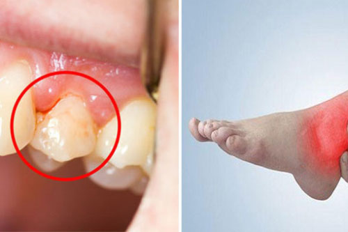 4 triệu chứng khi ngủ dậy chứng tỏ gan không tốt, cẩn thận suy gan nặng nề