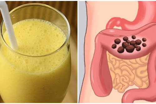 7 đồ uống tự nhiên thải độc đại tràng rất tốt, quét sạch cặn bã, giúp tiêu hóa trơn tru