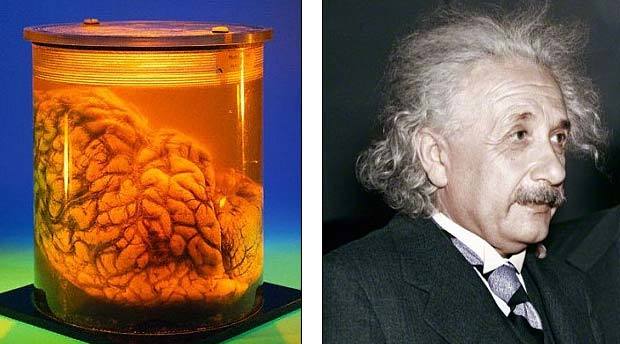 Người não to không thông minh hơn