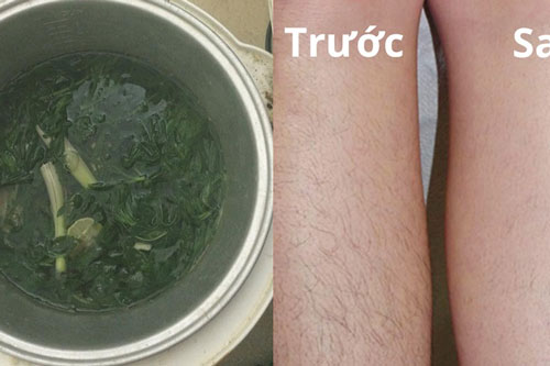 Tẩy sạch lông chân, lông tay chỉ bằng lá ngải cứu
