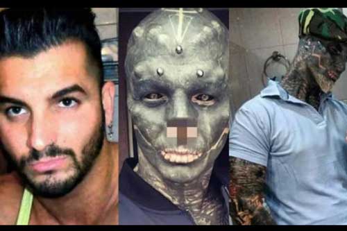 Thanh niên đang đẹp trai thì đi sửa mặt style "quái vật", cắt bỏ môi trên rồi mất luôn khả năng nói