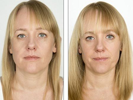 Tuyệt chiêu đơn giản giúp biến tóc mỏng thành dày