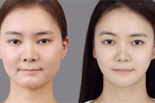 4 cách giảm béo mặt tại nhà bạn phải biết