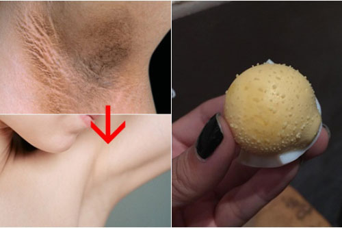 Trị hôi nách vĩnh viễn chỉ bằng trứng gà