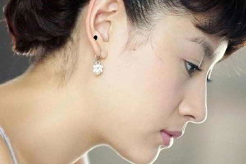 Nốt ruồi ở tai có thể biết trước tương lai giàu có sung túc an nhàn của bạn