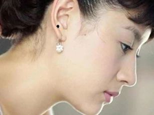 Nốt ruồi ở tai có thể biết trước tương lai giàu có sung túc an nhàn của bạn