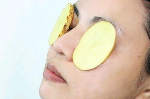Đánh tan thâm quầng mắt chỉ bằng lát khoai tây