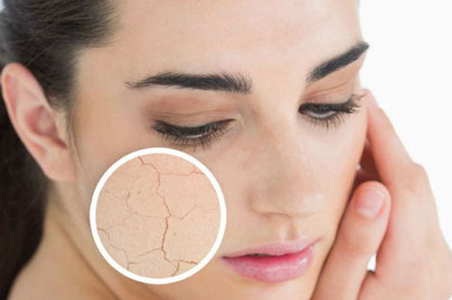 Thực phẩm cần hạn chế ăn nếu không muốn bị khô da