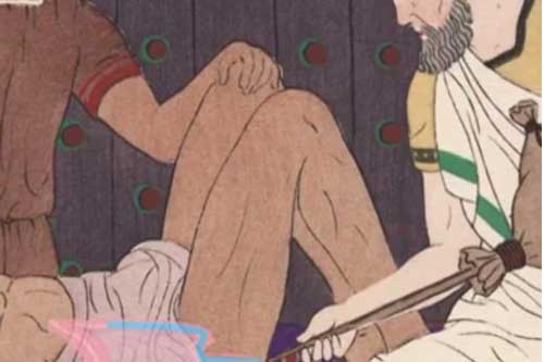 Quá khứ rùng rợn của kim tiêm: Thật may vì chúng ta sống ở thời hiện tại!