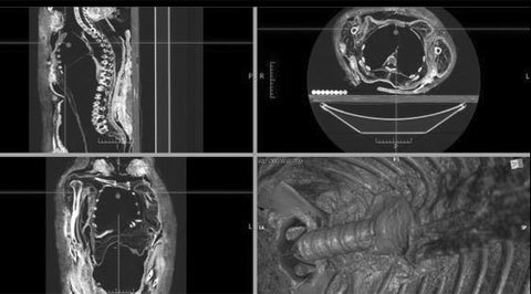 Phát hiện mới về thuật ướp xác của người Ai Cập