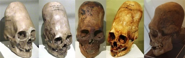ADN từ hộp sọ bí ẩn Paracas không giống của người