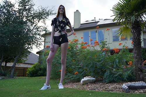 Người phụ nữ sở hữu cặp chân dài nhất thế giới