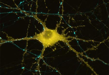 Phát hiện cách bộ não tạo ra ký ức