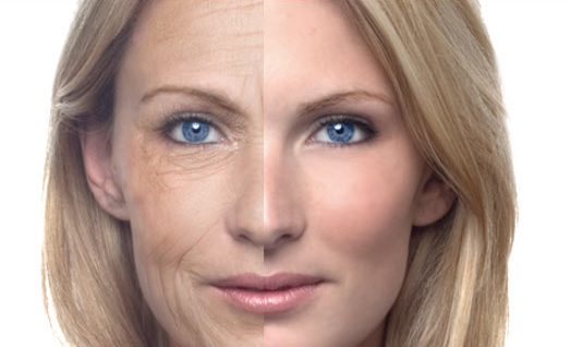 Bí quyết chống nhăn da mặt không cần đến mỹ phẩm