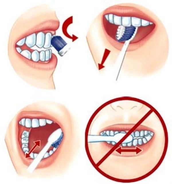 Đánh răng sai cách là nguyên nhân gây ra nhiều bệnh ung thư