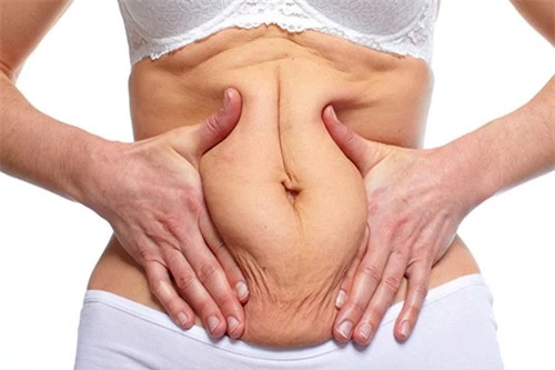 3 bước cải thiện vùng da bụng chảy xệ