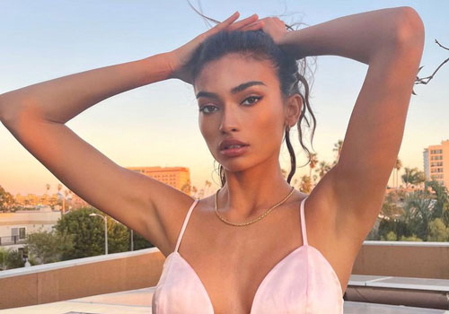 'Chân dài' cao 1m80 Kelly Gale căng đầy sức sống thanh xuân