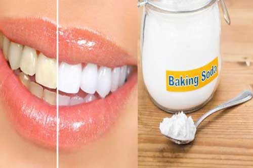3 cách làm răng trắng tại nhà với baking soda