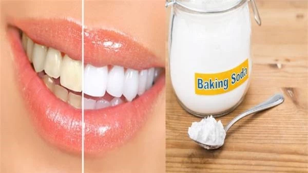 3 cách làm răng trắng tại nhà với baking soda