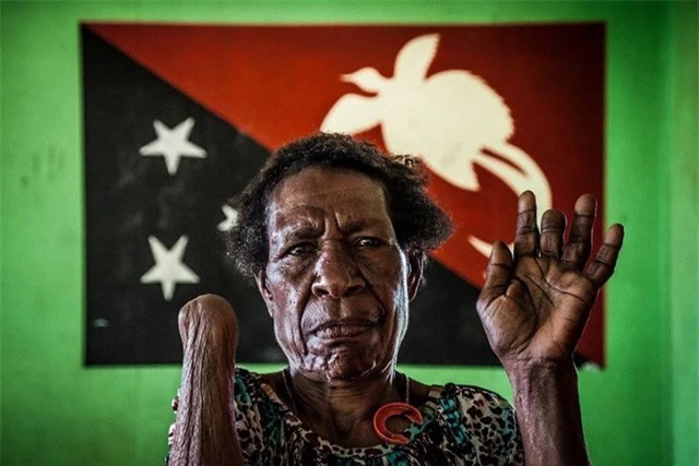 Số phận bi thảm của người bị kết tội phù thủy ở Papua New Guinea - Ảnh 4.