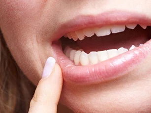 Dấu hiệu ung thư miệng bạn cần đi khám ngay