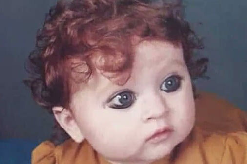 Bé gái sinh ra với ngoại hình khác lạ khiến người đời nguyền rủa là "quái vật", 20 năm sau lại làm ai cũng phải trầm trồ