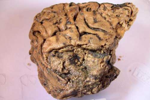 Chấn động: Phát hiện bộ não còn nguyên sau 2.600 năm