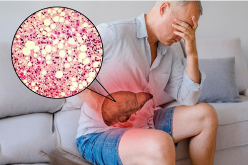Thói quen xấu buổi sáng làm tổn thương gan thận nghiêm trọng