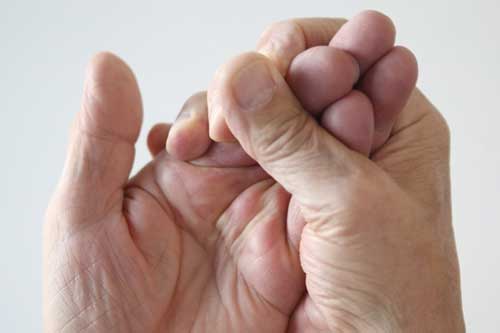 10 triệu chứng tê tay báo hiệu bệnh nguy hiểm