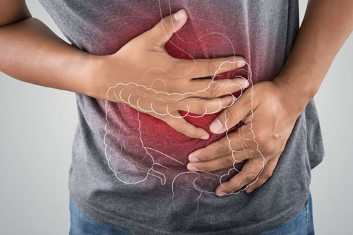 Nguyên nhân khiến bệnh viêm đại tràng tái đi tái lại