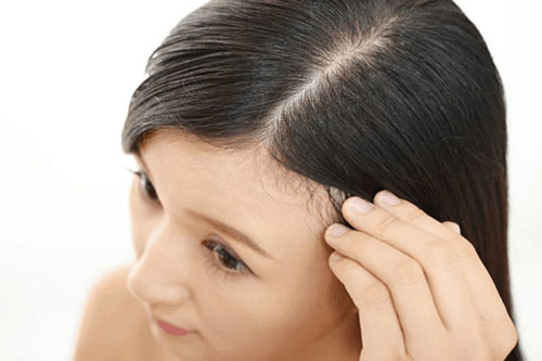 Xử lý tóc bết dính đơn giản hơn bạn nghĩ