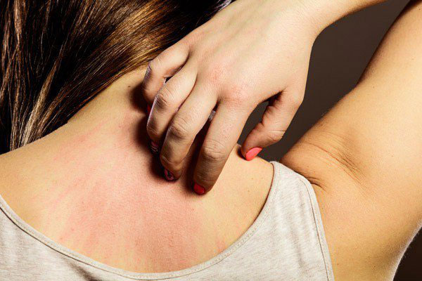 Trước khi ung thư ập đến, trên cơ thể sẽ có 2 cơn ngứa: Phát hiện sớm có thể giúp bạn cứu sống chính mình