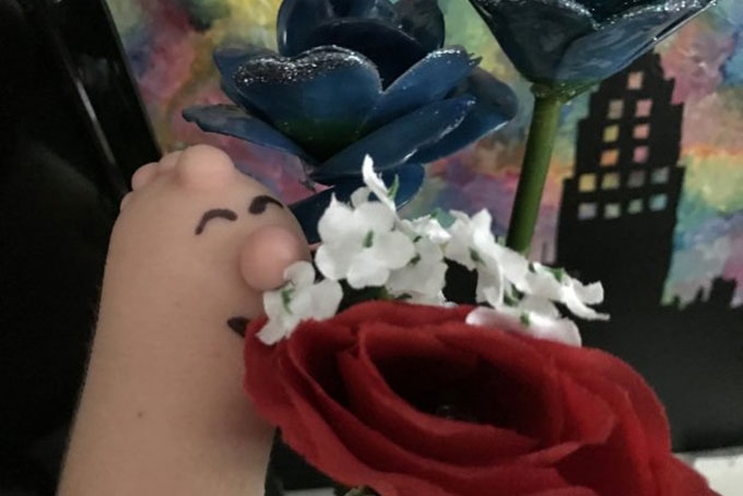 Cánh tay dị tật của cô bé 16 tuổi và bài học quý giá dành cho tất cả mọi người