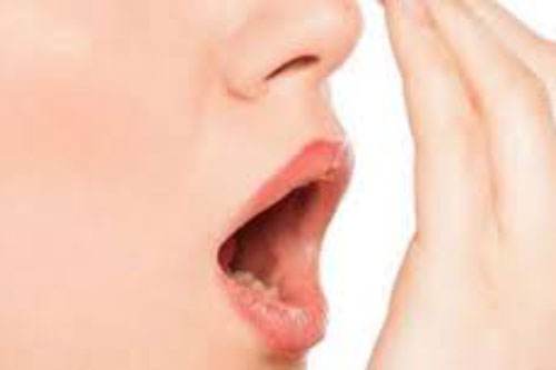 Những bài thuốc chữa hôi miệng cực kỳ hiệu quả