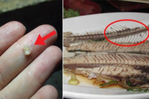 Mẹo chữa hóc xương cá chỉ "trong vòng 1 nốt nhạc"