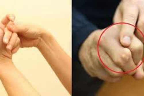 Bẻ khớp ngón tay để giãn gân cốt: Tưởng vô hại nhưng gây ra 1 căn bệnh đáng sợ