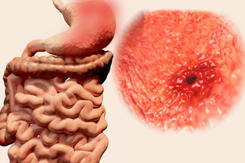 7 triệu chứng không đau nhưng có thể là dấu hiệu sớm của ung thư, hãy nhanh chóng đi gặp bác sĩ