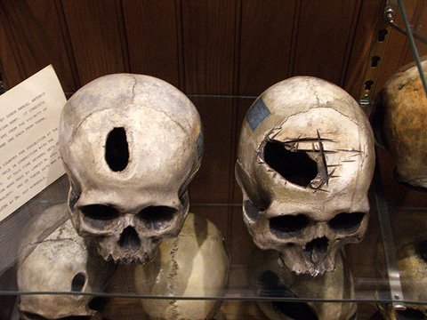 Viện bảo tàng không dành cho người yếu tim