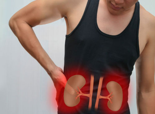 5 biểu hiện của suy thận hay bị mọi người bỏ qua