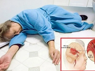 "Điểm mặt" 4 nhóm người dễ bị bệnh đột quỵ: Bỏ ngay thói quen tai hại này để bảo vệ chính mình