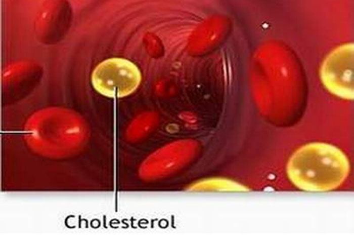 Vì sao người Việt ăn ít chất béo nhưng lại thừa cholesterol?