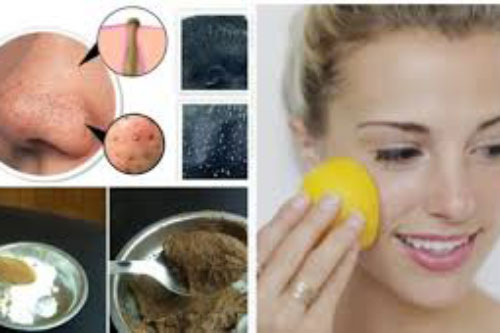 Mụn đầu đen, đầu trắng li ti nhiều đến mấy cũng hết nhờ chà thứ này lên da