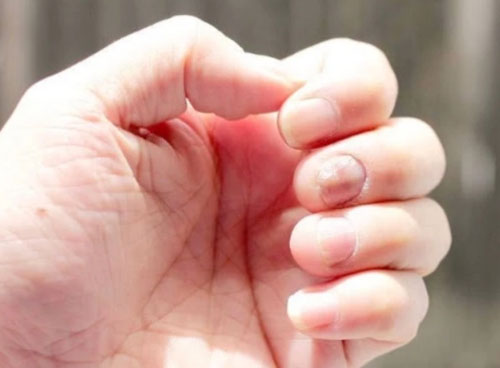 5 triệu chứng lặp đi lặp lại chứng tỏ gan đang tích tụ quá nhiều độc tố