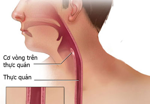 Dấu hiệu dễ thấy của ung thư thực quản